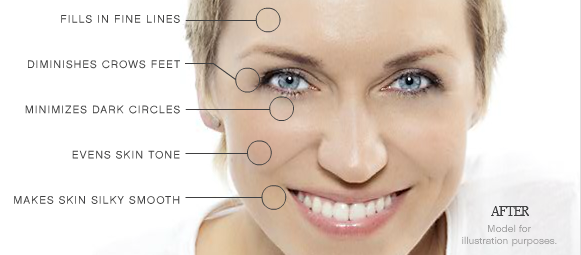 Kollagen Intensiv before and after